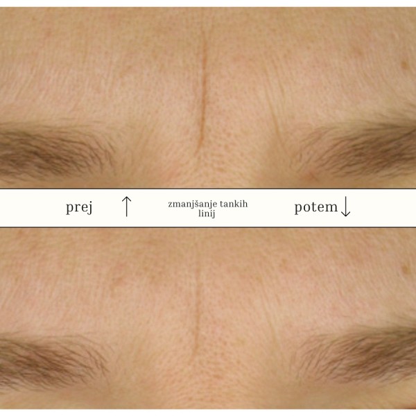 Maska z rožnimi cvetovi - gelna shaker