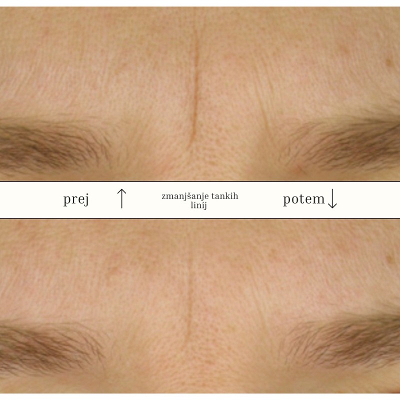 Maska z rožnimi cvetovi - gelna shaker